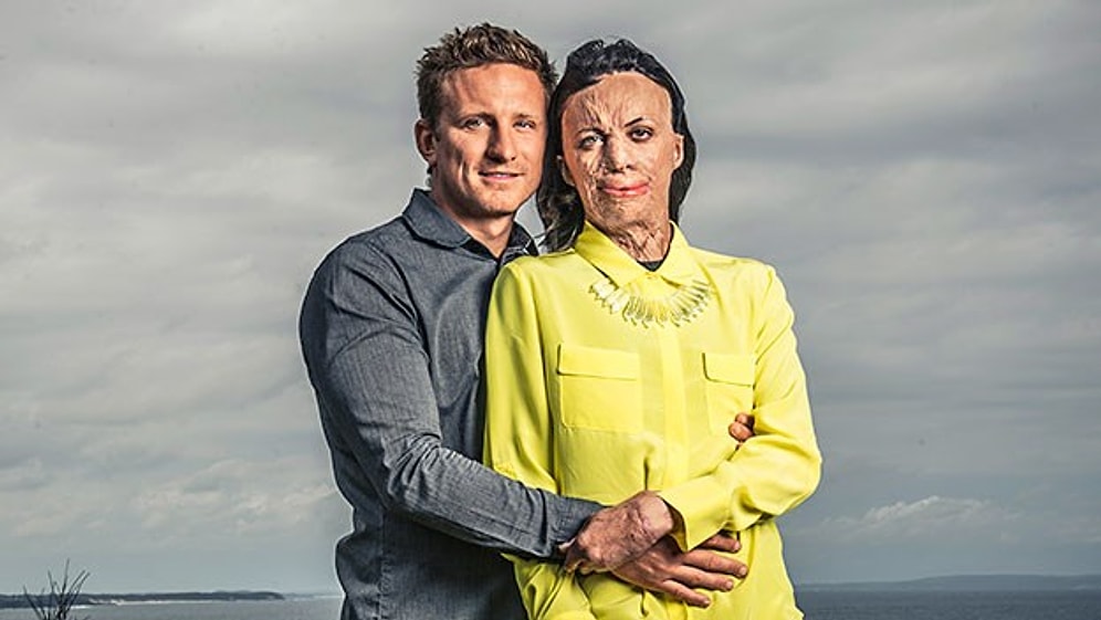 Küllerinden Yeniden Doğan O Kadın, Şimdi de Hayatının Aşkıyla Evleniyor!