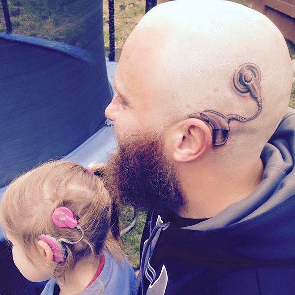 Baba Alistair Campbell kızını desteklemek ve onun yanında olduğunu göstermek için kafasının sol tarafına kızının kullandığı cihazın dövmesini yaptırır.