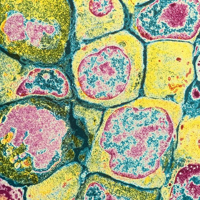Mikroskopla Görüntülenen İnsan Vücudundan Sanat Eseri Tadında 10 İlginç Fotoğraf