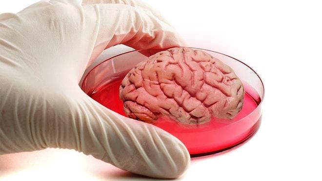 Bilim İnsanları Tam Fonksiyon Çalışan Bir İnsan Beyni Üretti