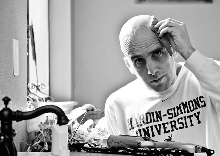 Saçları Dökülmeye Başlayınca Kafasını Kazıtan Erkeklere Dair Bilmeniz Gereken 17 Şey