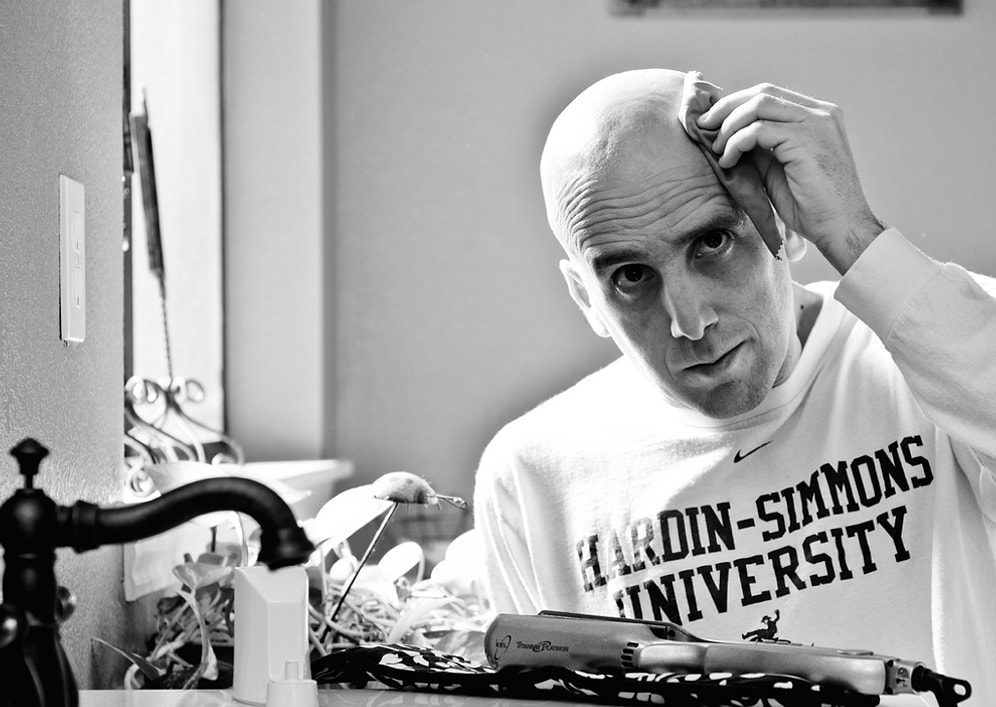 Saçları Dökülmeye Başlayınca Kafasını Kazıtan Erkeklere Dair Bilmeniz Gereken 17 Şey