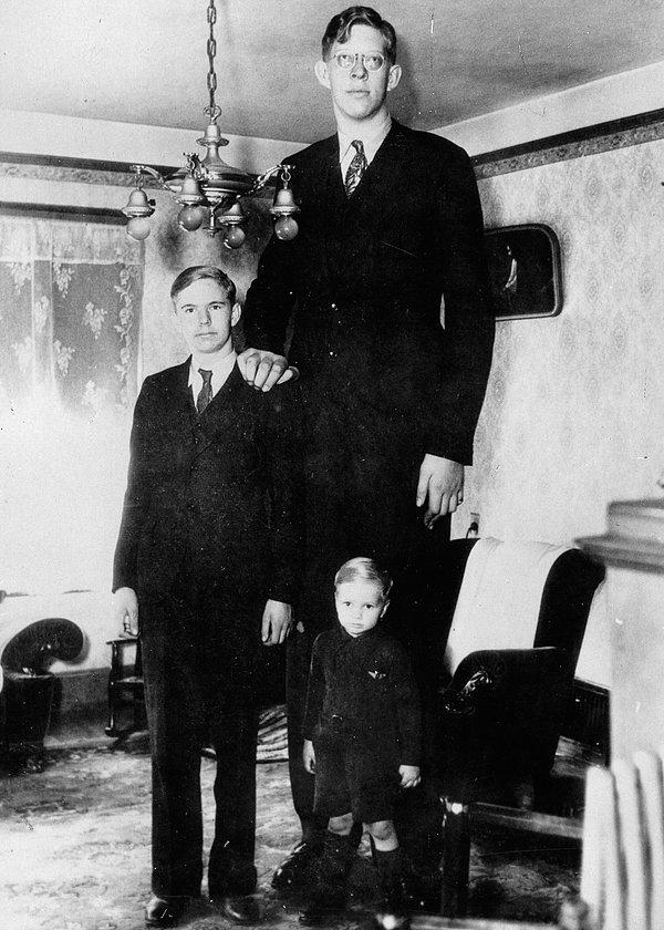 13 yaşında boyu 2.24 m olan Robert, Dünyanın En Uzun İzcisi unvanının sahibi olmuş. Sakin ve yumuşak başlı bir genç olması çevresinde 'Nazik Dev' olarak anılmasına yol açmış.