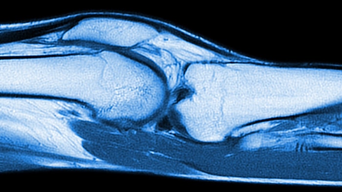 Parmakları Çıtlatmak Gerçekten Sağlığa Zararlı mı?