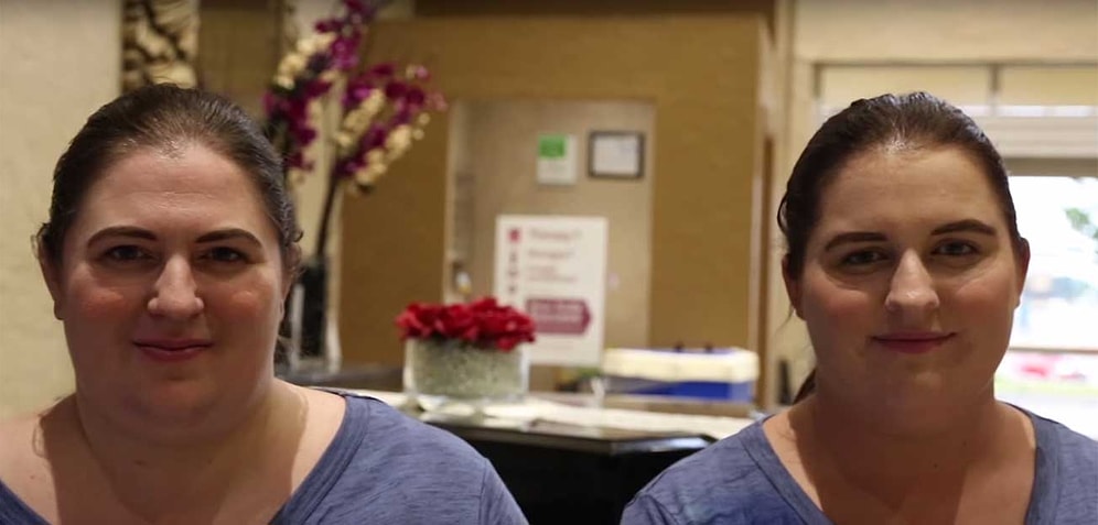 Birbirlerine Tamamen Yabancı Olmalarına Rağmen Aynı Yüze Sahip Olan İkili