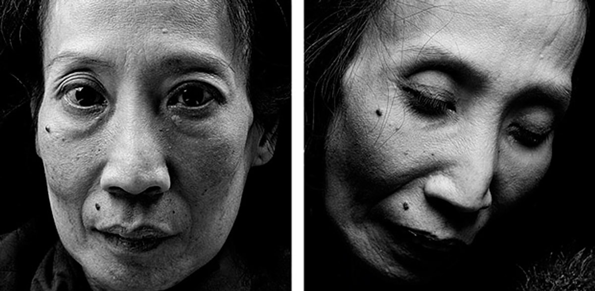 незрячее лицо