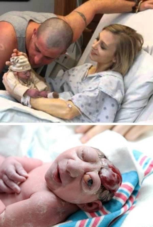 3. Doğuştan özrü olan bebeğin fotoğrafını kaldırdılar.