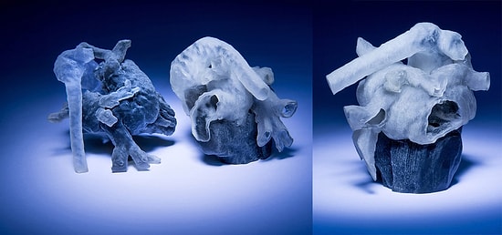 3D Yazıcılar ile Kalp Ameliyatı Öncesi Pratik Yapmak Mümkün