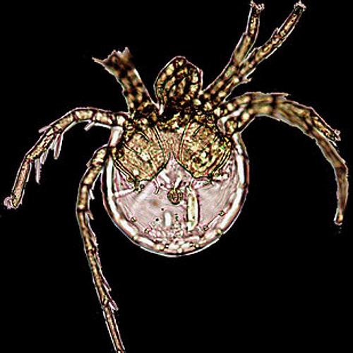 Jennifer Lopez – Litarachna lopezae