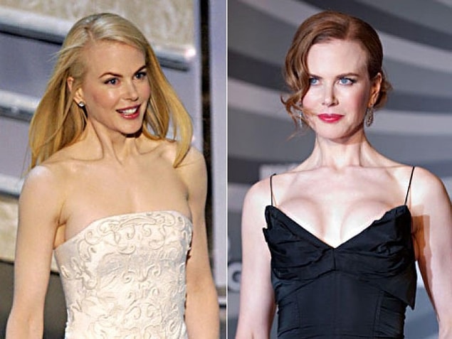 Nicole Kidman