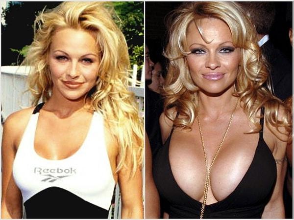 10. Pamela Anderson