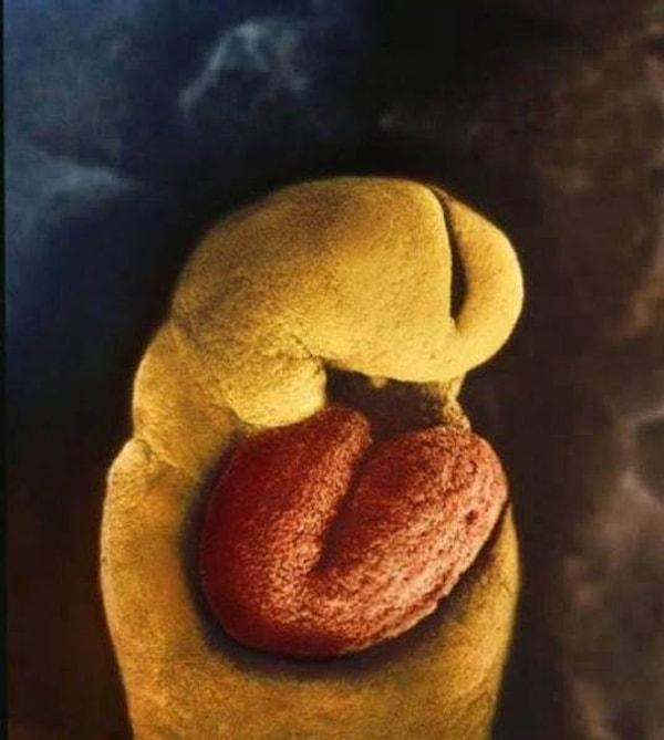 24. Gün: Embriyoda 18. günden itibaren atmaya başlayan bir kalp dışında hiçbir sistem gelişmemiş