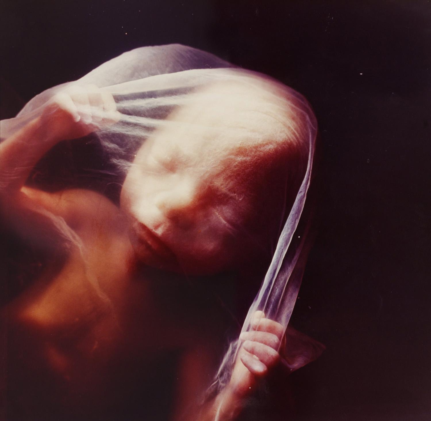Малыш на 23 неделе. Эмбрион Леннарт Нильсон. Эмбрион 18 недель Леннарт Нильссон. "Зародыш, 18 недель", Леннарт Нильсон, 1965..