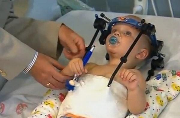 Başarılı geçen operasyon sonrası doktorunun yaptığı açıklamada "Bunu yaşayan birçok bebeğin anında öleceğini ve kurtulsa bile tekrar hareket edemeyeceklerini" ifade etti.