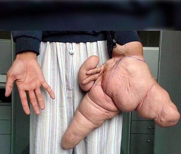 8. Самая большая рука (СЛИШКОМ ЧУВСТВИТЕЛЬНЫМ ЛУЧШЕ НЕ СМОТРЕТЬ!)