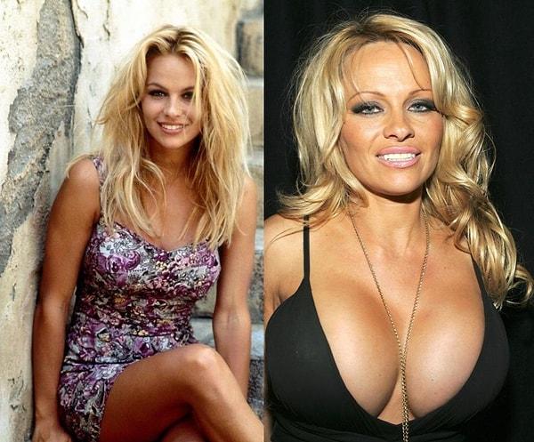 1. Pamela Anderson