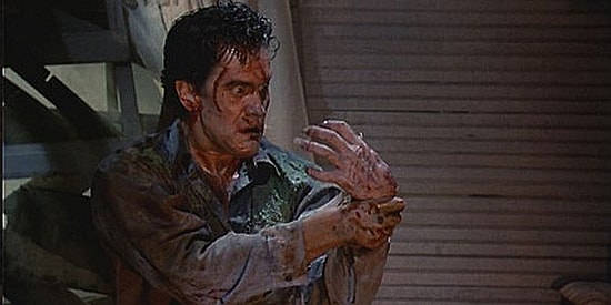 Hakim Olunamayan Bir El ve Yol Açtıklarıyla Tehlikeli Bir Hastalık: Yabancı El Sendromu