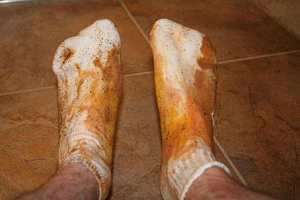 8. Bir çorap üç ay giyilmez. Çöpe at onları her gün de çoraplarını değiştir bu ne amk ya!
