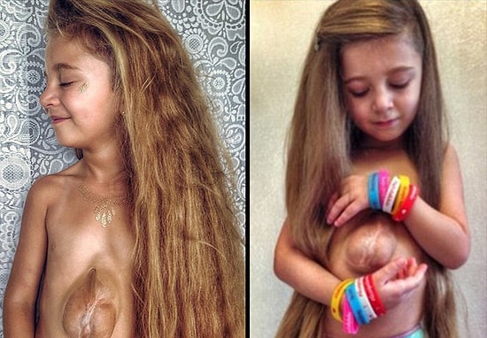 Minik Savaşçı: Kalbi Dışarıda Doğan 6 Yaşındaki Virsaviya Pes Etmiyor