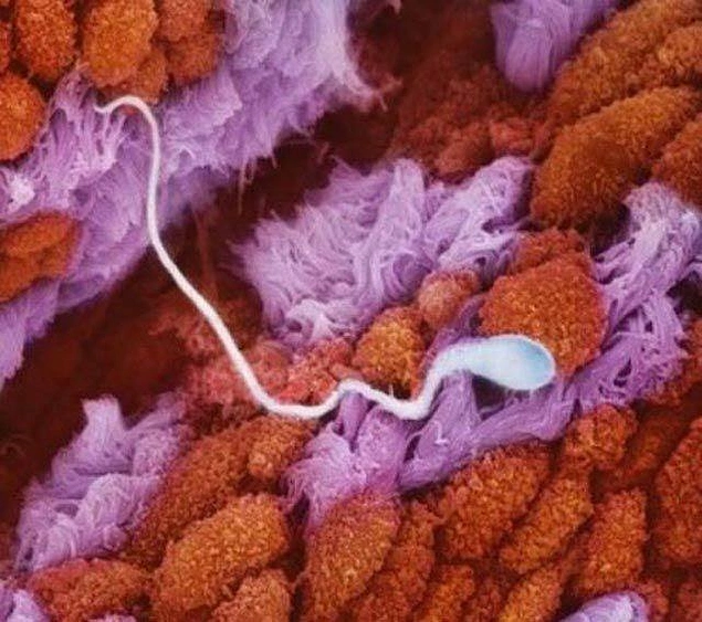 Продвижение сперматозоида к фаллопиевым трубам