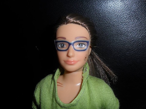 Царапины, прыщи, плохое зрение – все это бывает у обычной девушки