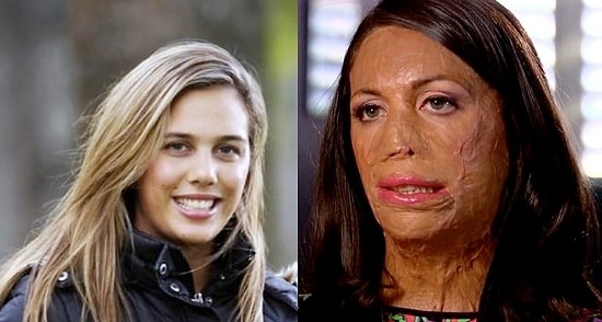 Девушка, восставшая из пепла