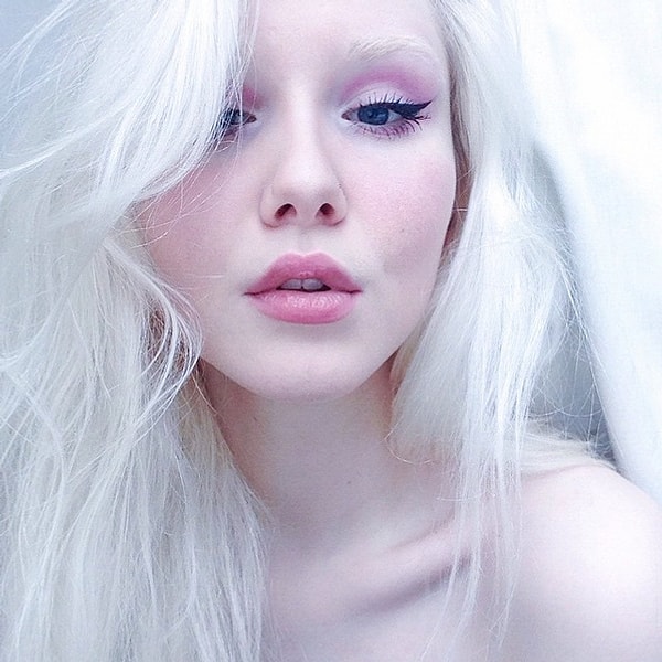 Ее белоснежная кожа стала визитной карточкой девушки