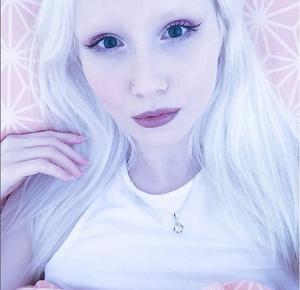 Даже ее брови и волосы белого цвета.