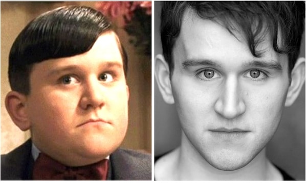 Harry Melling (Dudley Dursley)