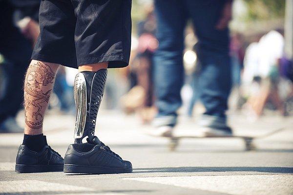 9. Hissedebilen protez bacak üretildi