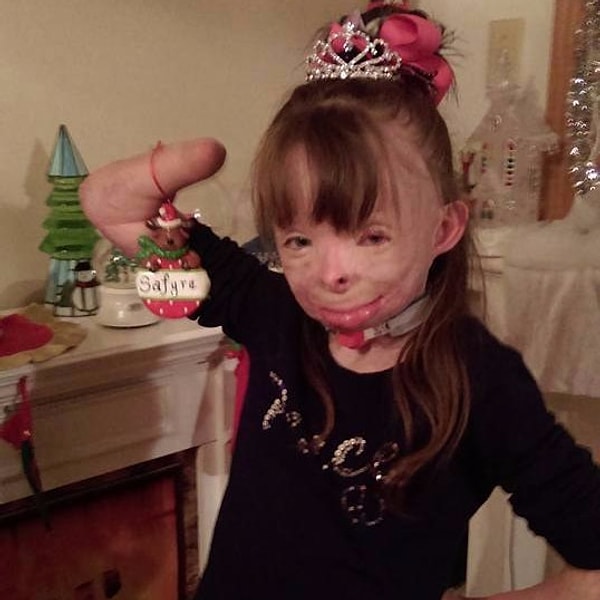 Кроме того, интернет-кампания, организованная с целью поддержать семью девочки, собрала уже больше 300’000$.