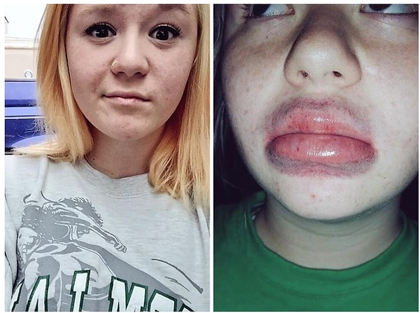 13. И, конечно, самый ужасающий тренд года - губы Кайли Дженнер.