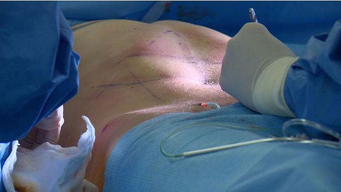 Obsesifliğin Bu Kadarı; Sırf Karın Kası İçin 4000 Km Yol Yapıp Türkiye'ye Gelen Adam