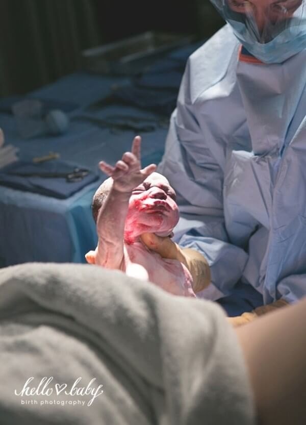 14. Новорождённый малыш делает первый вздох.