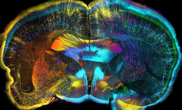29. Mikroskobun altındaki bu görüntü, fare beyninden alınan bir parça. Farklı sinir hücresi grupları farklı renklere boyanmış.