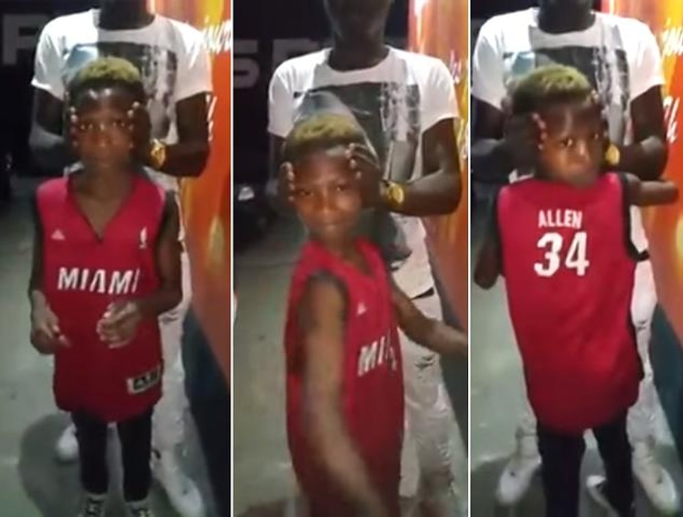 İnanılmaz Esnek! Kafasını 180 Derece Döndürebilen Çocuk