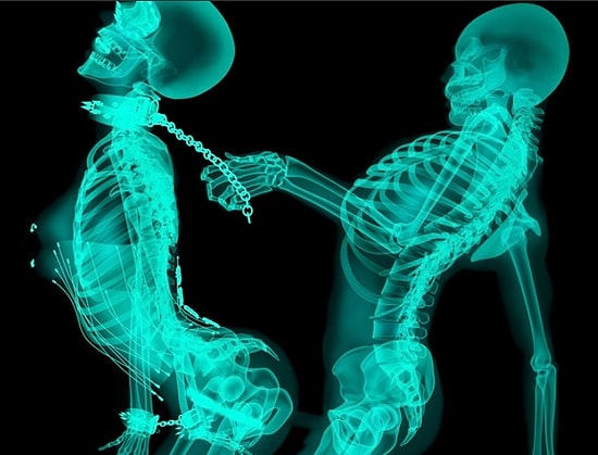 Рентген, как вид искусства в работах Ивана Цюпки