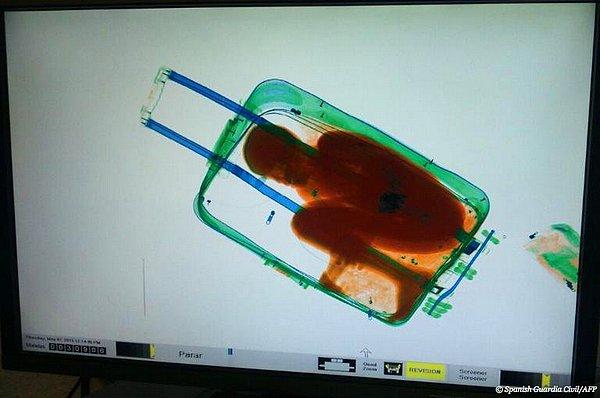 15. İspanya'da çalışanların x-ray aramasında bavulun içinde karşılarına çıkan 8 yaşındaki çocuk.