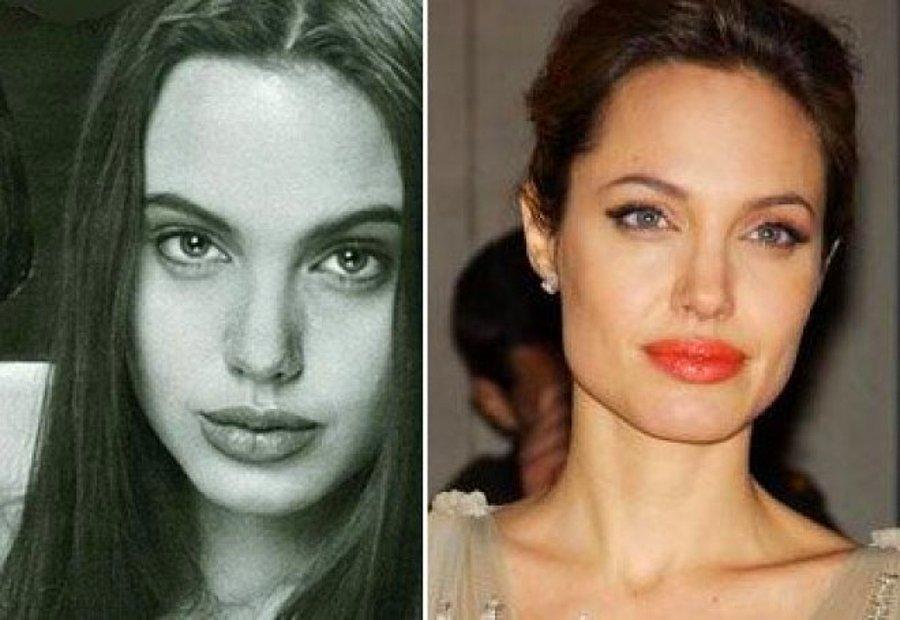 Анджелина джоли до пластики. Анджелина Джоли ринопластика. Анджелина Джоли до и после пластики. Анжелина Джоли до пластики лица.