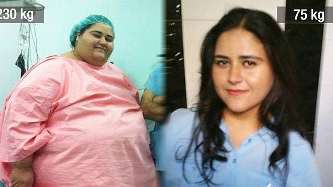 Hayata Yeniden Başlayanlar Kulübü: Obezite Cerrahisi