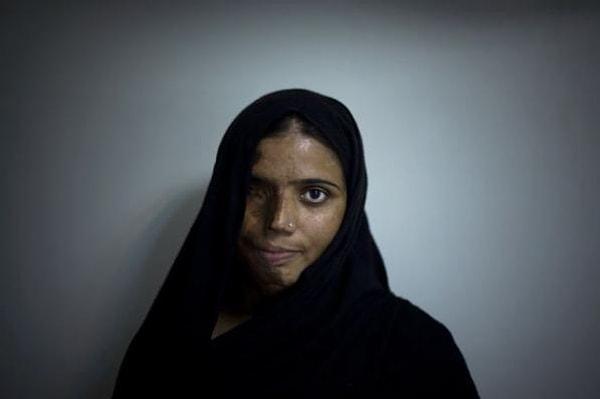 3. Pakistan, İran ve Afganistan'da binlerce kadın bu sonu yaşıyor.