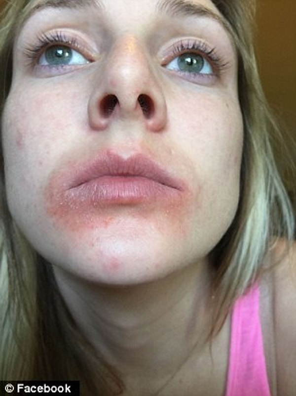 И, к сожалению, Рейчел в этом смысле не одинока.