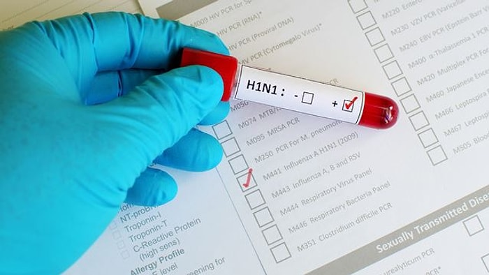 '27 Kişi H1N1, 2-3 Kişi H2N3 Virüsünden Hayatını Kaybetti'