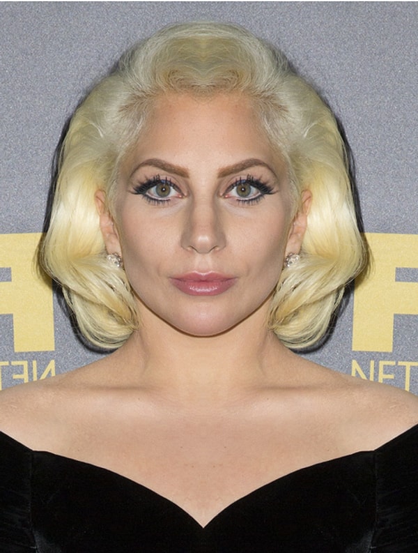 Первая категория – звезды с идеально симметричными лицами или «Фанаты пластической хирургии».