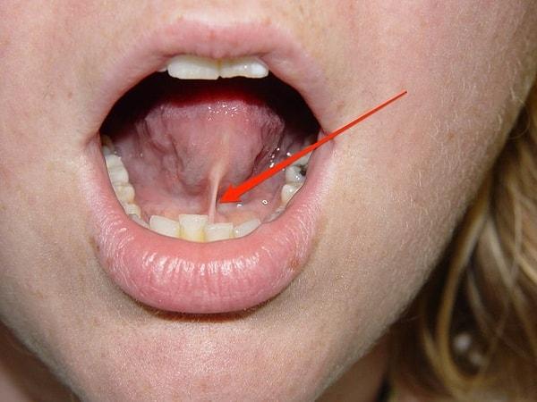 14. Frenulum: Dilinizin altında bulunan bağ.