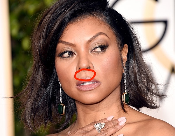 3. Фильтр - продольный жёлоб между верхней губой и носом.