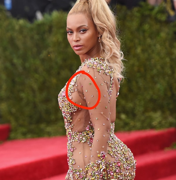 6. Аксилла - подмышка.