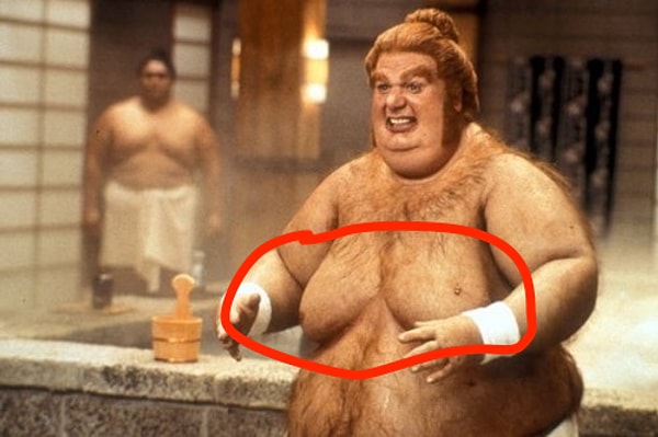 10. Гинекомастия - грудь у мужчин.