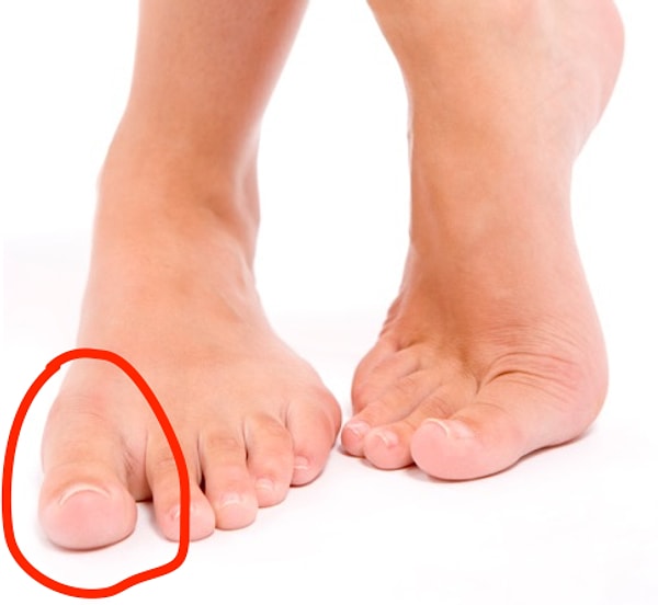 13. Халюс — это большой палец ноги.