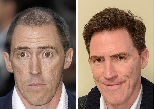 6. Rob Brydon